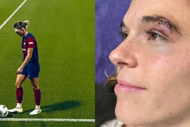 La jugadora española recibió un codazo por parte de una rival que le causó una herida.